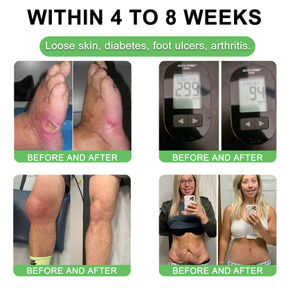 "Only 10 packs left — grab this exclusive upsell with an extra 30% OFF for faster slimming & firming in just 1–4 weeks!|𝐵uil𝗱𝐿ea𝐟®"