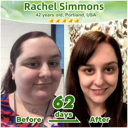 "Only 10 packs left — grab this exclusive upsell with an extra 30% OFF for faster slimming & firming in just 1–4 weeks!𝑩𝒖𝐢𝒍𝒅𝑳𝒆𝐚𝒇®"