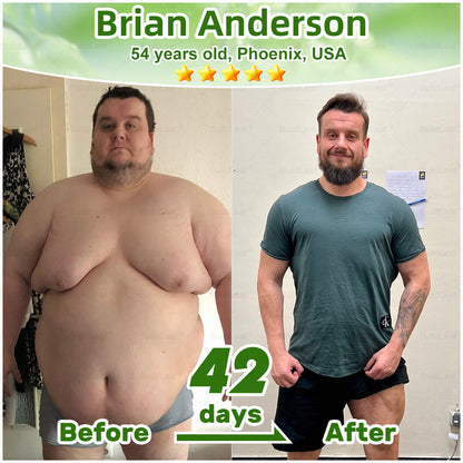 "Only 10 packs left — grab this exclusive upsell with an extra 30% OFF for faster slimming & firming in just 1–4 weeks!𝑩𝒖𝐢𝒍𝒅𝑳𝒆𝐚𝒇®"