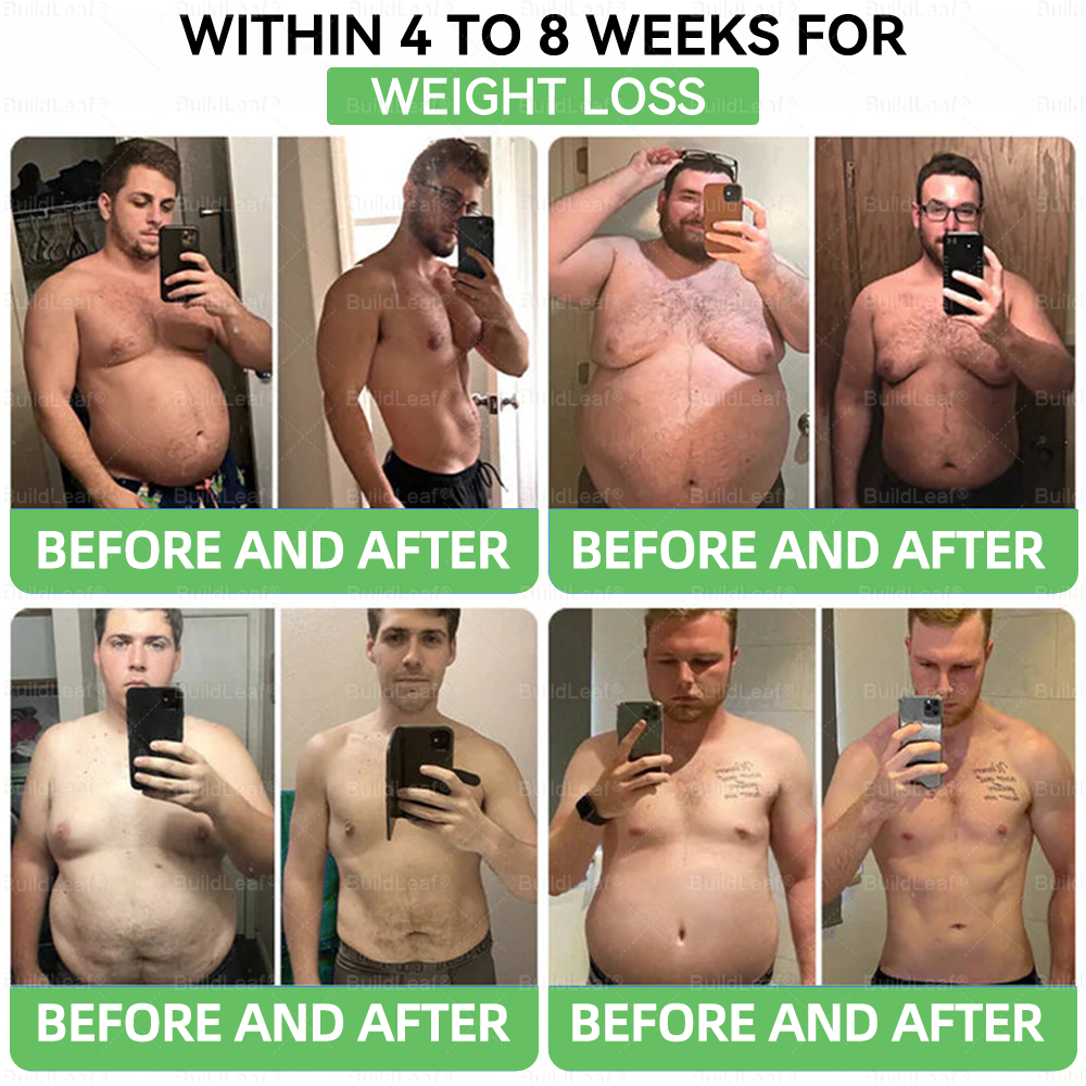 "Only 10 packs left — grab this exclusive upsell with an extra 30% OFF for faster slimming & firming in just 1–4 weeks!|𝐵uil𝗱𝐿ea𝐟®"