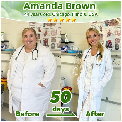 "Only 10 packs left — grab this exclusive upsell with an extra 30% OFF for faster slimming & firming in just 1–4 weeks!𝑩𝒖𝐢𝒍𝒅𝑳𝒆𝐚𝒇®"