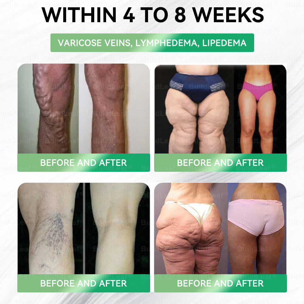 "Only 10 packs left — grab this exclusive upsell with an extra 30% OFF for faster slimming & firming in just 1–4 weeks!𝑩𝒖𝐢𝒍𝒅𝑳𝒆𝐚𝒇®"