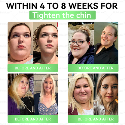 FDA 𝖮𝖿𝖿𝗂𝖼𝗂𝖺𝗅 𝖲𝗍𝗈𝗋𝖾 | 𝘽𝙪𝙞𝙡𝙙𝙇𝙚𝙖𝙛® 𝗚𝗟𝗣-𝟭 𝟖-𝗶𝗻-𝟭 𝗦𝗹𝗶𝗺 & 𝑯𝒆𝒂𝒍𝒕𝒉 𝑶𝒓𝒂𝒍 𝑺𝒐𝒍𝒖𝒕𝒊𝒐𝒏(𝑂𝑛𝑐𝑒 𝑎 𝑑𝑎𝑦, 𝑣𝑖𝑠𝑖𝑏𝑙𝑒 𝑟𝑒𝑠𝑢𝑙𝑡𝑠 𝑖𝑛 7 𝑑𝑎𝑦𝑠)  ✅ 𝗦𝘂𝗽𝗽𝗼𝗿𝘁𝘀 𝗼𝗯𝗲𝘀𝗶𝘁𝘆, 𝗰𝗮𝗿𝗱𝗶𝗼𝘃𝗮𝘀𝗰𝘂𝗹𝗮𝗿 𝗵𝗲𝗮𝗹𝘁𝗵, 𝗱𝗶𝗮𝗯𝗲𝘁𝗲𝘀, 𝘀𝗹𝗲𝗲𝗽 𝗮𝗽𝗻𝗲𝗮, 𝗴𝘂𝘁 𝗵𝗲𝗮𝗹𝘁𝗵, 𝗷𝗼𝗶𝗻𝘁 𝗶𝘀𝘀𝘂𝗲𝘀, 𝐰𝐡𝐢𝐥𝐞 𝐚𝐥𝐬𝐨 𝐟𝐢𝐫𝐦𝐢𝐧𝐠 𝐭𝐡𝐞 𝐬𝐤𝐢𝐧 𝐚𝐧𝐝 𝐛𝐨𝐨𝐬𝐭𝐢𝐧𝐠 𝐞𝐧𝐞𝐫𝐠𝐲.